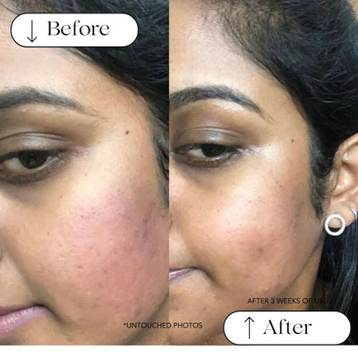 Turmeric + Rose Anti-inflammatory Facial Cleanser (Oily to Normal Skin)